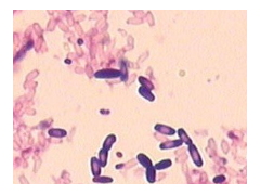 GB 4789.13-2012 食品安全国家标准 食品微生物学检验 产气荚膜梭菌检验 检测标准